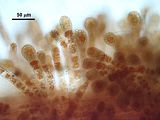 Particolare degli assi eretti aplostici e degli organi uniloculari apicali